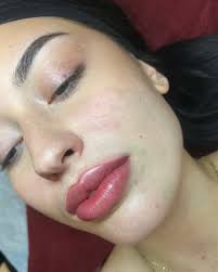 Cherry Chapstick Lips 🍒 Swipe for her before !, To me, these are beautiful  results. So smooth, plump and colourful. To some, this may be way too  intense and probably scary. , When a potential client ...