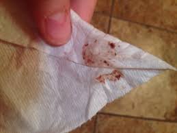 It can be caused by in addition, in more serious cases this type of discharge can also indicate vaginal cancer, cervical cancer, or endometrial cancer, so a gynecologist. Red Blood Smears Then Brown Flaky Blood Babycenter