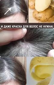 как избавиться от волос на животе навсегда в домашних условиях Kak Prosto Izbavitsya Ot Sediny V Domashnih Usloviyah Lekarstva Dlya Volos Maski Dlya Volos Shampun Dlya Rosta Volos