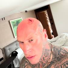 I just want to put the record straight, this wasn't David !!! Aka @mickoola  BUT a fight with a shaver 😂😂😂😂😂 #goliath #david #shaver #not #stone