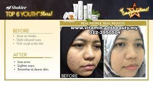 Maybe you would like to learn more about one of these? Produk Kecantikan Yang Selamat Dan Berkesan 2021