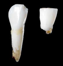 Cabinet Leftovers Where Do Teeth Go