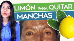 La exposición al sol produce la mayor parte de las manchas de sol. Restaurante Llave Inglesa Calendario Como Quitar Las Manchas Oscuras De La Piel Mydoclabs Com