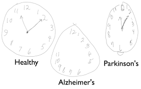Check spelling or type a new query. Could A Pen Change How We Diagnose Brain Function Mit News Massachusetts Institute Of Technology