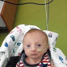 Parental origin of the extra chromosome 18 in edwards syndrome. Parents Of Infant With Edwards Syndrome Chicago Tribune