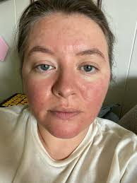 Tracy Huntley (@tracy_h_esthetics) • Instagram photos and videos