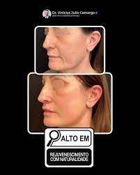 O seu desejo é alto em quê? 😅 Me conta nos comentários. Dr. Vinicius Julio  Camargo Médico Cirurgião Plástico