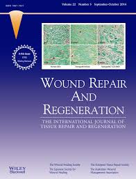 Savesave mou kantor pos krian for later. Treatment With Ll 37 Is Safe And Effective In Enhancing Healing Of Hard To Heal Venous Leg Ulcers A Randomized Placebo Controlled Clinical Trial Gronberg 2014 Wound Repair And Regeneration Wiley Online Library
