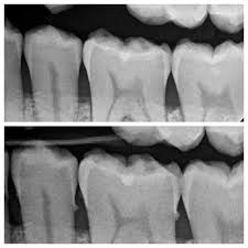 Maybe you would like to learn more about one of these? Pin On Before After Magic