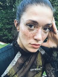 Maybe you would like to learn more about one of these? These 5 Models Are Revolutionizing The Freckle Movement Across All Skin Tones Vogue