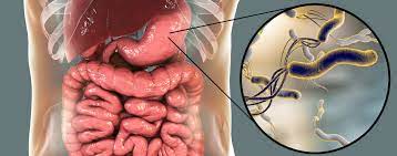 Die magenschleimhaut übernimmt im menschlichen organismus eine sehr wichtige funktion. Magenschleimhautentzundung Symptome Und Ursachen Focus Arztsuche