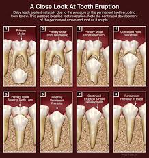 Pin On Dentistry