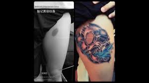 All of these cover up tattoo artists are incredible, few of the best are listed below: Custom Birthmark Coverup With Skull Tattoo By Singapore Best Tattoo Artist Youtube