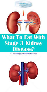 Vitamin D Kidney Disease Kidney Disease Painful Legs Hypoplastic Kidney Disease Kidney Disease Cure Kidney Disease Recipes Kidney Disease Kidney Disease Diet