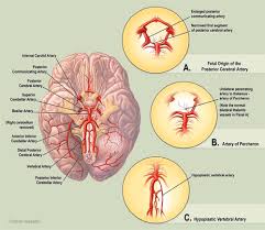 Image result for Posterior Circulation