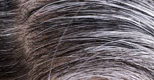 Reversing grey hair is one thing, and stopping grey hair from coming back is another thing. White Hair Causes And Ways To Prevent It