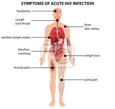 Diagramm Das Die Symptome Einer Akuten Hiv Infektion Zeigt Fototapete Fototapeten Dass Medicals Orgel Myloview De