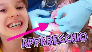 ALYSSA TAGLIA I CAPELLI CORTI! 😮✂️