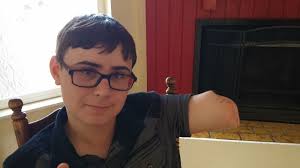 After the shark bite: how one boy inspired us