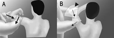 Image result for Shoulder Exam