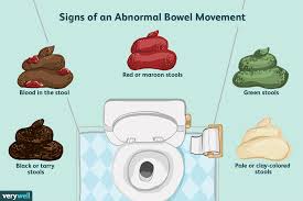 What Your Poop Says About Your Health