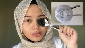 Namun kondisi yang disebut mata panda ini berbeda dengan memar akibat cedera atau iritasi akibat infeksi. Cuma Guna Sudu Sejuk Mampu Hilangkan Lingkaran Gelap Bawah Mata Pesona Pengantin