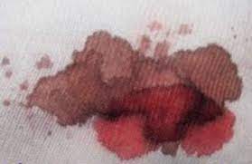 We did not find results for: Tache De Sang Seche On Elimine Ces Taches Avec De L Ammoniaque A 28 Puis Eventuellement Avec De L Enlever Tache De Sang Tache De Sang Nettoyer Tache De Sang