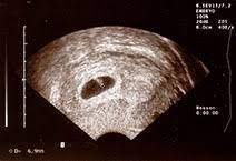 Video aus der großen ultraschalluntersuchung in der 20. Vaginalsonographie Wie Funktioniert Ultraschall Eigentlich Ultraschalluntersuchungen Untersuchungen Medizinisches Schwangerschaft Swissmom Ch