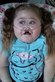 Layla Jeanne Lloyd, 3, peacefully passed away in her parents' arms  Saturday, Nov. 24, 2018, surrounded by her family. Layla was born July 9,  2015, in Marshfield, Wis., to the parents of