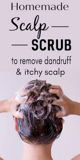 My Mom S Secret Scalp Scrub After Using This My Hair Are Growing Like Never Before In 2020 With Images Hair Dandruff Homemade Scalp Treatments Dry Scalp Treatment Diy