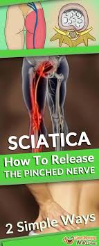 Pin On Sciatica