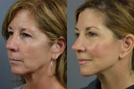 Best Cosmetic Surgeon