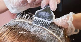 For the eyes are likely to become inflamed and irritated, you should be careful not to splash water or shampoo into your eyes. Dyeing Hair When You Have Psoriasis Tips For Staying Safe