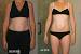 Omnicentric Tracy Anderson Results