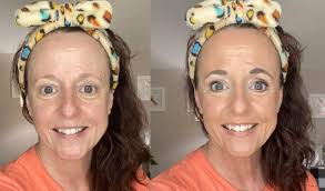 PIGMENTATION ISSUES! 😭 Yesterday we touched