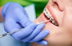 Behind the Brackets: What Happens During Your Checkups
