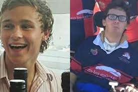 Resta paralizzato dopo aver mangiato una lumaca: Sam muore a 28 anni dopo 8  di agonia