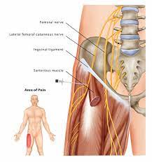 Check spelling or type a new query. Lateral Femoral Cutaneous Nerve Block Pain Treatment Pain Spa Bristol Uk