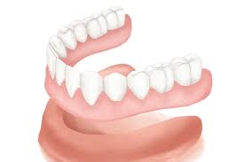 They fit better, function better, and look much more superior to the traditional dentures. Dentures Partial Complete Full Removable Best Set Costa Mesa Ca California Dentistry At Its Finest