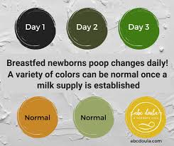 Image result for Newborn Stool Color