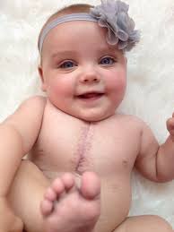 Baby with one in three million mix of heart conditions and five per cent  chance of survival undergoes heart operation at just one minute old