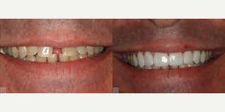 Tom Hedge, DDS, Dentist