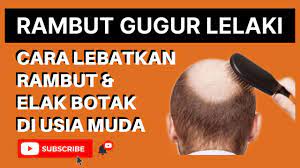 Tidak dipungkiri bahwa hal itu mampu membuat wanita bisa terlihat lebih menawan. Rambut Gugur Lelaki Cara Lebatkan Rambut Elak Kepala Botak Youtube