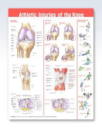 Athletic Injuries Of The Knee Chart 20x26 Clinicalposters