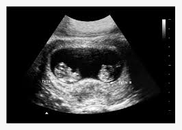 You can also access the past some of these apps are entirely free while others would need a premium subscription for their advanced features. Fake Ultrasound Generator For Free Baby Maybe