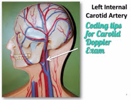 They are the carotid arteries, and they carry blood to the brain. Cpt Code 93880 93882 For Carotid Doppler Coding Tips