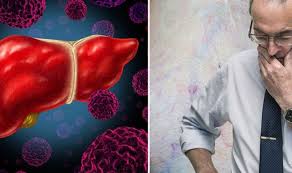 Voici les signes à ne pas négliger, surtout en cas de maladie du foie déjà avérée. Symptomes Du Cancer Du Foie Des Veines Enflees Sous La Surface De L Abdomen Sont Un Signe Fr24 News France