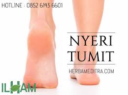 Obat Tradisional Nyeri Tumit Super Ampuh Tumit
