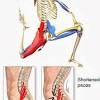 Back and hip extension activities during trunk flexion/extension: Https Encrypted Tbn0 Gstatic Com Images Q Tbn And9gcqwlfkfjelbcnbsyuogzhhosarluuignayntggb Ec4p97awd73 Usqp Cau