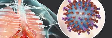 Respiratory syncytial virus (rsv) is amongst the most important pathogenic infections of childhood and is associated with significant morbidity and mortality. Respiratorisches Synzytial Virus Dritthaufigste Virale Ursache Fur Einen Stationaren Aufenthalt Medical Tribune